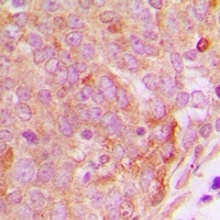 PP15 Rabbit Polyclonal Antibody