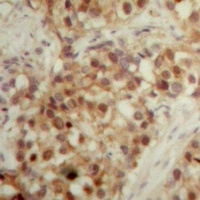 LONP2 Rabbit Polyclonal Antibody