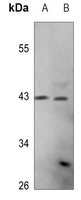 PEX10 Rabbit Polyclonal Antibody