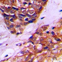 PEX10 Rabbit Polyclonal Antibody