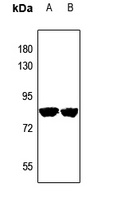 PRPF39 Rabbit Polyclonal Antibody
