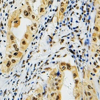 PRPF39 Rabbit Polyclonal Antibody