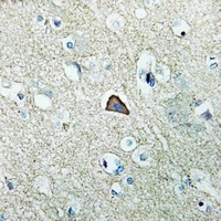 RhoG Rabbit Polyclonal Antibody