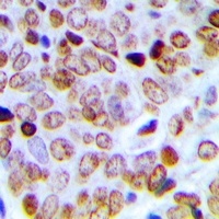 SFRS15 Rabbit Polyclonal Antibody