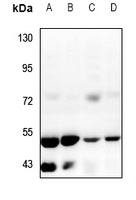 ZFYVE19 Rabbit Polyclonal Antibody