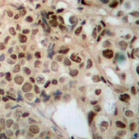 ZFYVE19 Rabbit Polyclonal Antibody