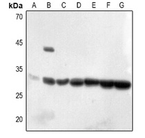 ECI1 Rabbit Polyclonal Antibody