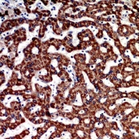 ECI1 Rabbit Polyclonal Antibody