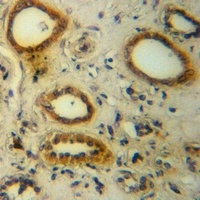 CD61 Rabbit Polyclonal Antibody