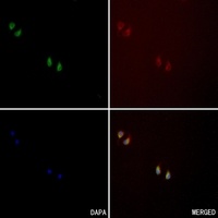 CD61 Rabbit Polyclonal Antibody