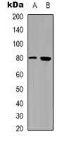 CD248 Rabbit Polyclonal Antibody