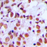 Histone H2A.X (Phospho-S139) Antibody
