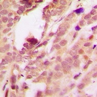 p38 (Phospho-T180/Y182) Antibody