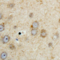 SPHK2 Rabbit Polyclonal Antibody