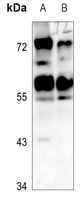 CADM1 Rabbit Polyclonal Antibody