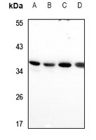 RIMS4 Rabbit Polyclonal Antibody