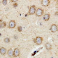 RIMS4 Rabbit Polyclonal Antibody
