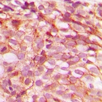 B-RAF (Phospho-S446) Rabbit Polyclonal Antibody