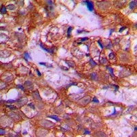 DZIP3 Rabbit Polyclonal Antibody