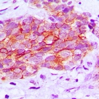 EGFR (Phospho-Y1016) Antibody