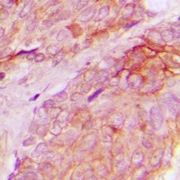 WASF1 (Phospho-Y125) Antibody