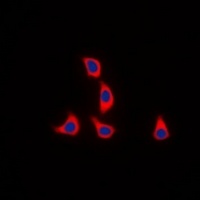 WASF1 (Phospho-Y125) Antibody