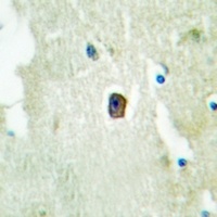 HER3 (Phospho-Y1289) Antibody