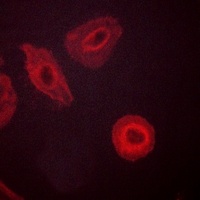 HER3 (Phospho-Y1289) Antibody
