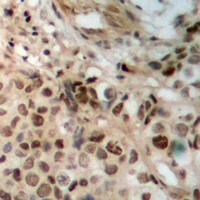 JAK2 Antibody