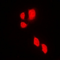 JAK2 Antibody
