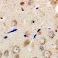 GAB1 Rabbit Polyclonal Antibody