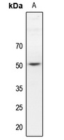 Dematin Rabbit Polyclonal Antibody