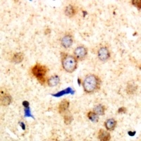 Dematin Rabbit Polyclonal Antibody