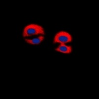 Dematin Rabbit Polyclonal Antibody