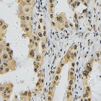 TBX1 Antibody