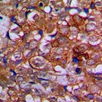 EPHA1 Antibody