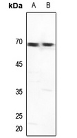 GTF2H1 Antibody