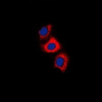 Recoverin Rabbit Polyclonal Antibody