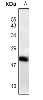 ID4 Rabbit Polyclonal Antibody