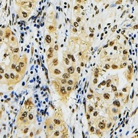 ID4 Rabbit Polyclonal Antibody