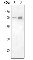 FOXK1 Rabbit Polyclonal Antibody