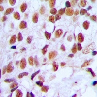 FOXK1 Rabbit Polyclonal Antibody