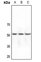 DOK7 Rabbit Polyclonal Antibody