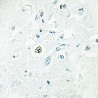 DOK7 Rabbit Polyclonal Antibody