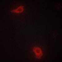 DOK7 Rabbit Polyclonal Antibody