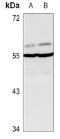 Glycerate Kinase Rabbit Polyclonal Antibody