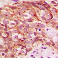 Glycerate Kinase Rabbit Polyclonal Antibody