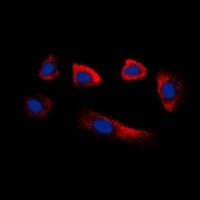 Glycerate Kinase Rabbit Polyclonal Antibody