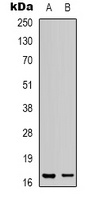 LMO3 Rabbit Polyclonal Antibody