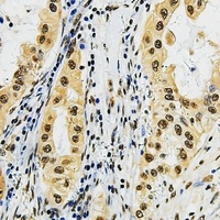 LMO3 Rabbit Polyclonal Antibody